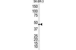 Western blot analysis of anti-ADRB2 Antibody in SK-BR-3 cell line lysates (35 µg/lane). (beta 2 Adrenergic Receptor antibody  (Thr384))