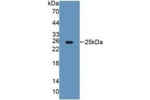 Detection of Recombinant AGXT, Rat using Polyclonal Antibody to Alanine Glyoxylate Aminotransferase (AGXT) (AGXT antibody  (AA 182-371))