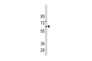 Western Blotting (WB) image for anti-Cytochrome P450, Family 1, Subfamily B, Polypeptide 1 (CYP1B1) (AA 143-176) antibody (ABIN392376)