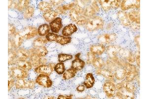 ABIN6256518 and ABIN6267413 at 1/100 staining human normal kidney tissue by IHC-P.