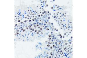 Immunohistochemistry (IHC) image for anti-Ribosomal Protein S6 Kinase, 70kDa, Polypeptide 1 (RPS6KB1) (pSer424), (pThr421) antibody (ABIN6136296)
