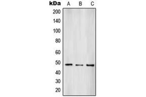 Western blot analysis of SUV39H2 expression in HepG2 (A), A431 (B), HL60 (C) whole cell lysates. (SUV39H2 antibody  (Center))