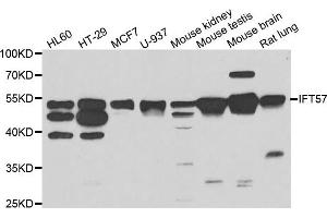 Western blot analysis of extracts of various cell lines, using IFT57 antibody. (IFT57 antibody)