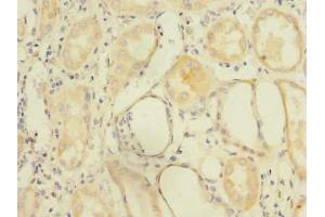 Immunohistochemistry of paraffin-embedded human kidney tissue using ABIN7162558 at dilution of 1:100 (ZDHHC6 antibody  (AA 227-409))