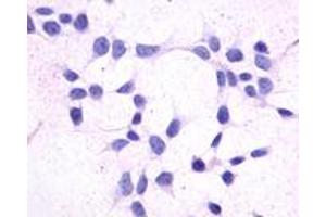 Immunocytochemistry (ICC) image for anti-Prostaglandin D2 Receptor 2 (PTGDR2) (Extracellular Domain) antibody (ABIN1048827)