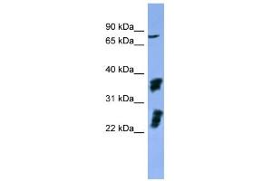WB Suggested Anti-FGFR2 Antibody Titration: 0. (FGFR2 antibody  (C-Term))