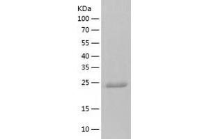 Western Blotting (WB) image for Syntaxin Binding Protein 6 (Amisyn) (STXBP6) (AA 1-210) protein (His tag) (ABIN7125296) (STXBP6 Protein (AA 1-210) (His tag))