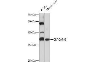 Western blot analysis of extracts of various cell lines, using CE Rabbit mAb (ABIN7266085) at 1:1000 dilution. (CEACAM6 antibody)