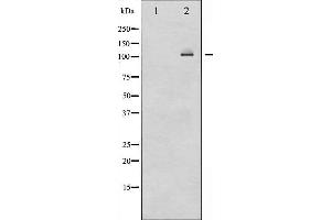 Western blot analysis of NF-kappaB p100/p52 expression in ovary cancer whole cell lysates,The lane on the left is treated with the antigen-specific peptide. (NFKB2 antibody  (C-Term))