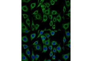 Immunofluorescence (IF) image for anti-Peripheral-Type Benzodiazepine Receptor (TSPO) (AA 1-50) antibody (ABIN7269228)