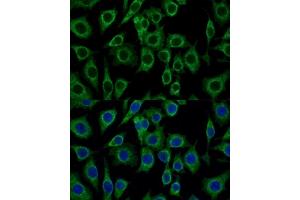 Immunofluorescence analysis of L929 cells using PBR/PBR/TSPO Polyclonal Antibody (ABIN7269228) at dilution of 1:100 (40x lens). (TSPO antibody  (AA 1-50))