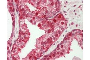 Human Prostate: Formalin-Fixed, Paraffin-Embedded (FFPE). (GBP2 antibody  (AA 74-123))