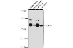 Western blot analysis of extracts of various cell lines, using ENTPD6 antibody (ABIN7266897) at 1:1000 dilution. (ENTPD6 antibody  (AA 61-300))