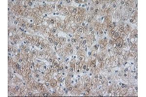 Image no. 5 for anti-Acetyl-CoA Acetyltransferase 2 (ACAT2) antibody (ABIN1496403) (ACAT2 antibody)