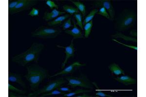 Immunofluorescence of purified MaxPab antibody to PBK on HeLa cell. (PBK antibody  (AA 1-322))
