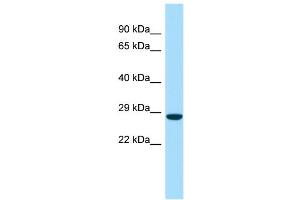 Host:  Rabbit  Target Name:  Fam3a  Sample Type:  Rat Pancreas lysates  Antibody Dilution:  1. (FAM3A antibody  (C-Term))