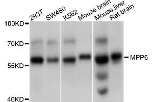 Western blot analysis of extracts of various cell lines, using MPP6 antibody (ABIN5998250) at 1/1000 dilution. (MPP6 antibody)