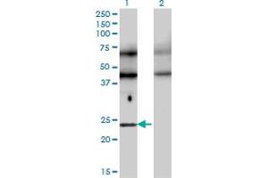 Western Blot analysis of TFEC expression in transfected 293T cell line by TFEC monoclonal antibody (M08), clone 4F11.