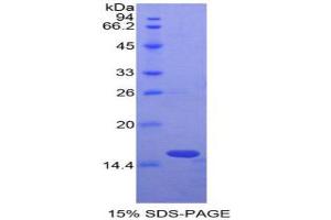 SDS-PAGE (SDS) image for Oncomodulin (OCM) (AA 1-109) protein (His tag) (ABIN1821764) (Oncomodulin Protein (OCM) (AA 1-109) (His tag))
