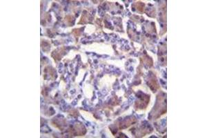 Formalin fixed and paraffin embedded human pancreas tissue reacted with RSS3 Antibody (Center) followed by peroxidase conjugation of the secondary antibody and DAB staining. (PRSS3 antibody  (Middle Region))