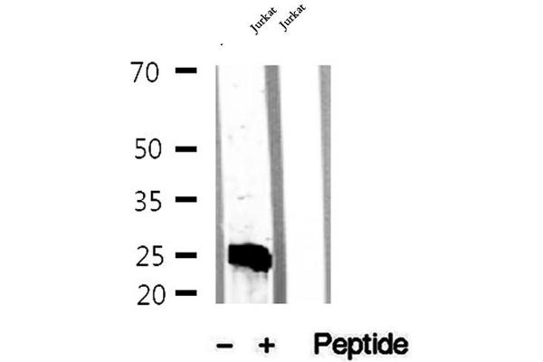 MPZL2 antibody  (Internal Region)