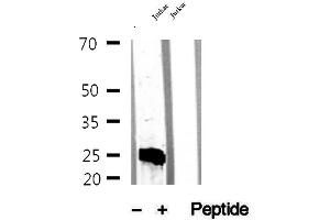 Western blot analysis of extracts of Jurkat cells, using MPZL2 antibody. (MPZL2 antibody  (Internal Region))