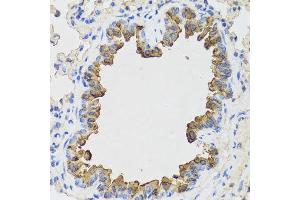 Immunohistochemistry of paraffin-embedded mouse lung using B9D1 antibody at dilution of 1:100 (x40 lens). (B9D1 antibody)