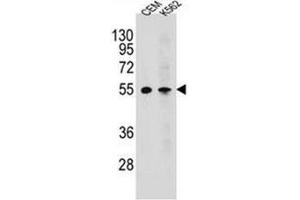 Western blot analysis of MCHR1 / GPR24 Antibody (C-term) in CEM,K562 cell line lysates (35ug/lane). (MCHR1 antibody  (C-Term))