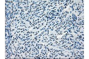 Image no. 7 for anti-Crystallin, alpha B (CRYAB) antibody (ABIN1497644) (CRYAB antibody)