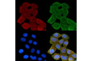 ABIN6264443 and ABIN6278623 staining Hela cells(30 min of UV treatment) by IF/ICC. (PSCA antibody  (Internal Region))