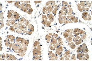 Human Muscle (KLHL31 antibody  (C-Term))