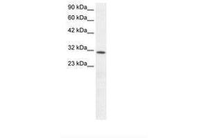 Image no. 1 for anti-Kruppel-Like Factor 8 (KLF8) (AA 89-138) antibody (ABIN6735825) (KLF8 antibody  (AA 89-138))