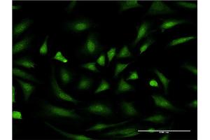 Immunofluorescence of monoclonal antibody to PIM1 on HeLa cell. (PIM1 antibody  (AA 1-100))