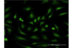 Immunofluorescence of monoclonal antibody to PIM1 on HeLa cell. (PIM1 antibody  (AA 1-100))