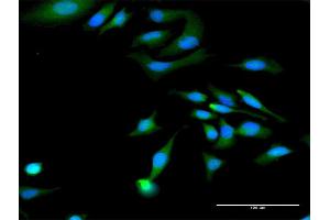 Immunofluorescence of purified MaxPab antibody to MAGED1 on HeLa cell. (MAGED1 antibody  (AA 1-778))