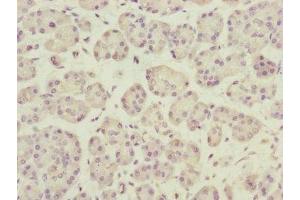 Immunohistochemistry of paraffin-embedded human pancreatic tissue using ABIN7150809 at dilution of 1:100 (DCTN3 antibody  (AA 1-176))