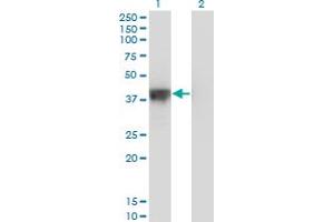 Western Blot analysis of DFFA expression in transfected 293T cell line by DFFA monoclonal antibody (M05), clone 3A11. (DFFA antibody  (AA 231-331))