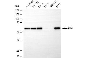 Western blotting analysis using FTO antibody (ABIN7798581).