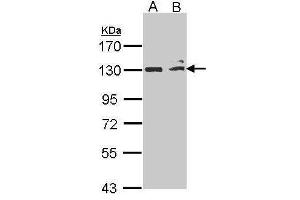 WB Image Sample (30 ug of whole cell lysate) A: H1299 B: Hep G2 , 7. (MAP3K14 antibody  (N-Term))