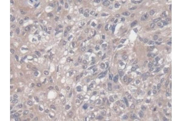 VEGF121 antibody  (AA 28-147)