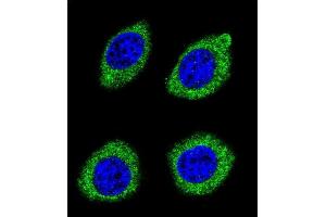 Confocal immunofluorescent analysis of HSD11B1L Antibody (C-term) (ABIN655425 and ABIN2844963) with U-251MG cell followed by Alexa Fluor 488-conjugated goat anti-rabbit lgG (green). (HSD11B1L antibody  (C-Term))
