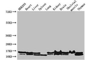 Western Blot Positive WB detected in: HEK293 whole cell lysate, Mouse heart tissue, Mouse liver tissue, Mouse spleen tissue, Mouse lung tissue, Mouse kidney tissue, Mouse brain tissue, Mouse skeletal muscle tissue, Mouse thymus tissue All lanes: NDUFB6 antibody at 3 μg/mL Secondary Goat polyclonal to rabbit IgG at 1/50000 dilution Predicted band size: 16, 14 kDa Observed band size: 16, 14 kDa (NDUFB6 antibody  (AA 2-67))