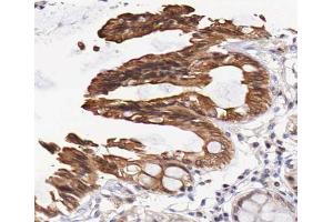 Immunohistochemistry (IHC) image for anti-Epidermal Growth Factor Receptor (EGFR) (pThr693) antibody (ABIN6256596)