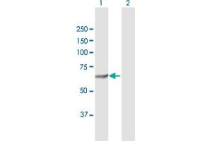 Western Blot analysis of SQLE expression in transfected 293T cell line by SQLE MaxPab polyclonal antibody. (SQLE antibody  (AA 1-574))