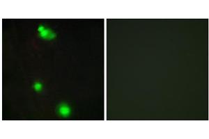 Immunofluorescence analysis of MCF-7 cells, using SFRS3 antibody. (SRSF3 antibody  (C-Term))