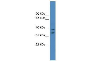 Western Blot showing UFD1L antibody used at a concentration of 1-2 ug/ml to detect its target protein. (UFD1L antibody  (Middle Region))