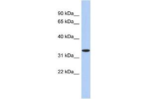 WB Suggested Anti-ASPA Antibody Titration: 0. (ASPA antibody  (N-Term))