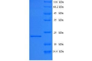 Interferon epsilon (IFNE) (AA 24-195), (full length) protein (His tag) expressed in E. (IFNE Protein (AA 24-195, full length) (His tag))