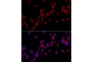 Immunofluorescence analysis of THP-1 cells using TLR4 Rabbit pAb (ABIN6134489, ABIN6149223, ABIN6149226 and ABIN6220893) at dilution of 1:100 (40x lens). (TLR4 antibody  (AA 500-600))