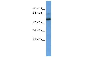 WB Suggested Anti-IQCB1 Antibody Titration: 0. (IQCB1 antibody  (C-Term))